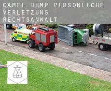 Camel Hump  persönliche verletzung rechtsanwalt